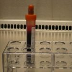 Nuevo test médico abre una vía para detectar cáncer de páncreas